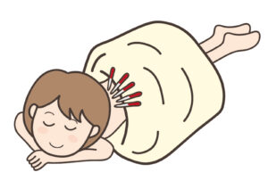 鍼灸治療　シリウス訪問治療所